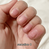Oil Growth & Gel Removal (2 - in - 1) - The Maison Aurora CH