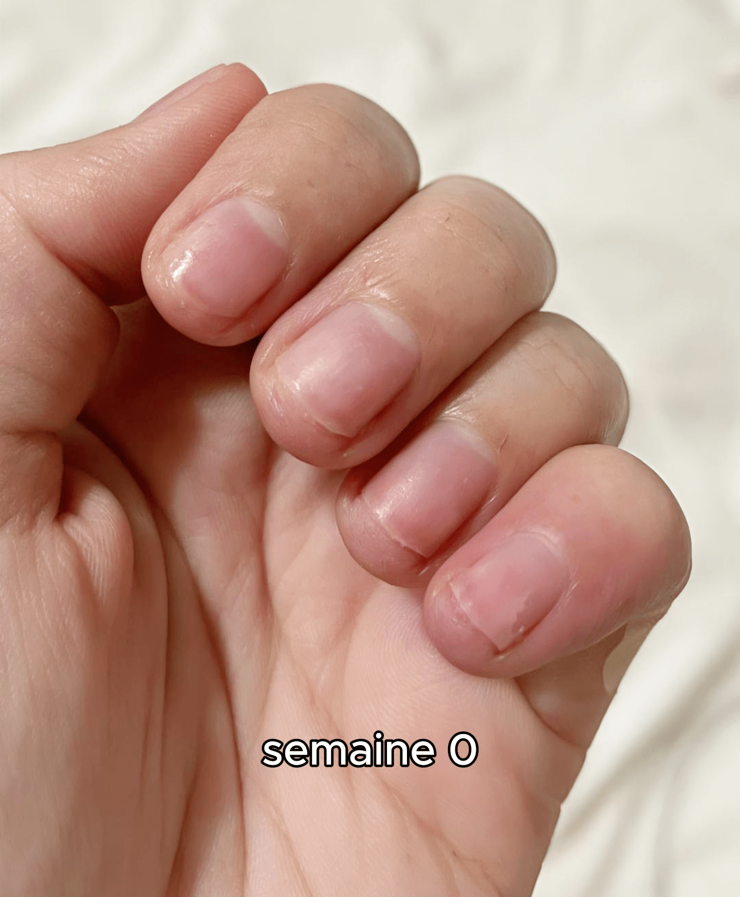 Oil Growth & Gel Removal (2 - in - 1) - The Maison Aurora CH